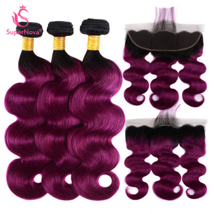 Bundles With Frontal