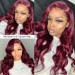 lace closure wig